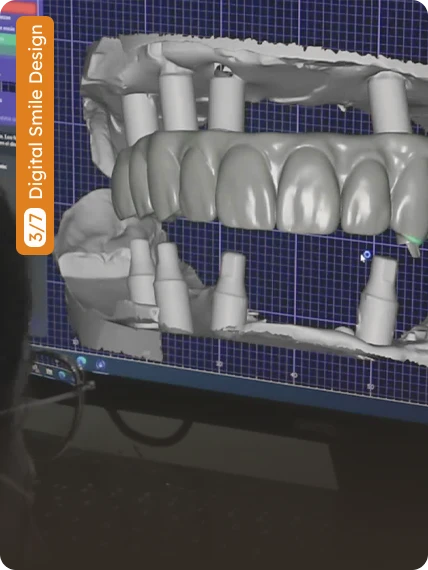 Cancun Dental Specialists (CDS) — photo 10