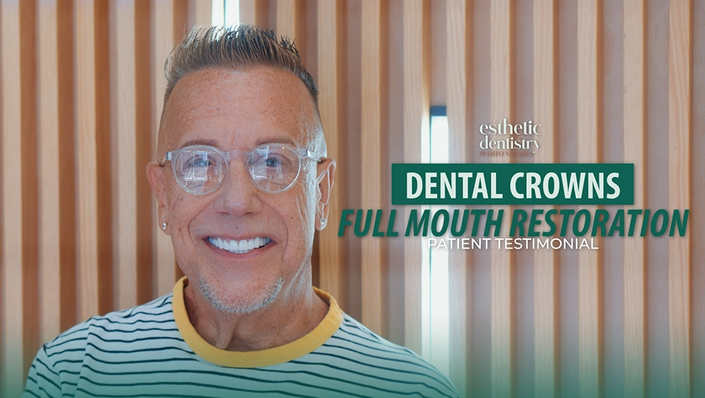 Esthetic Dentistry Puerto Vallarta