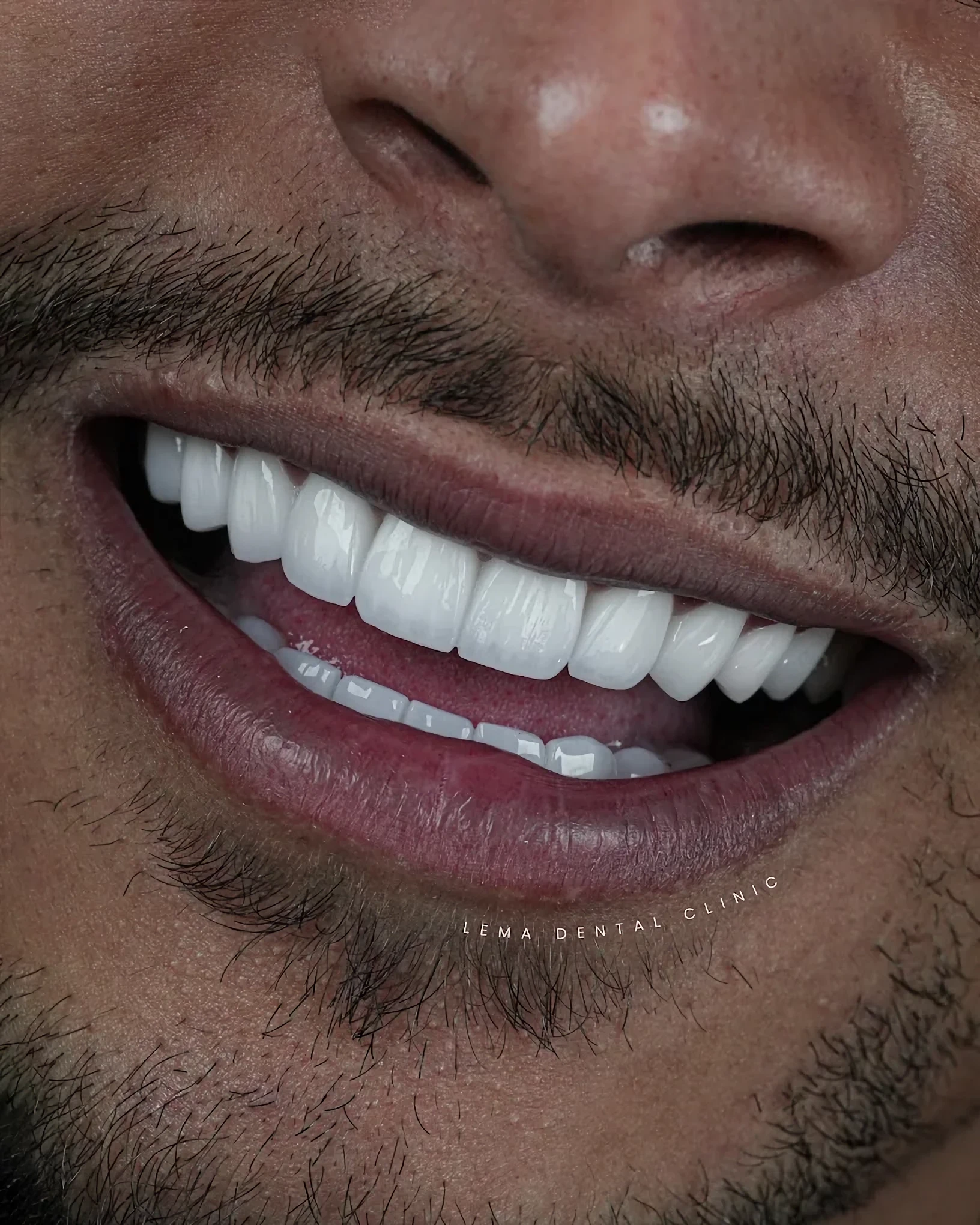 Lema Dental Clinic — photo 6