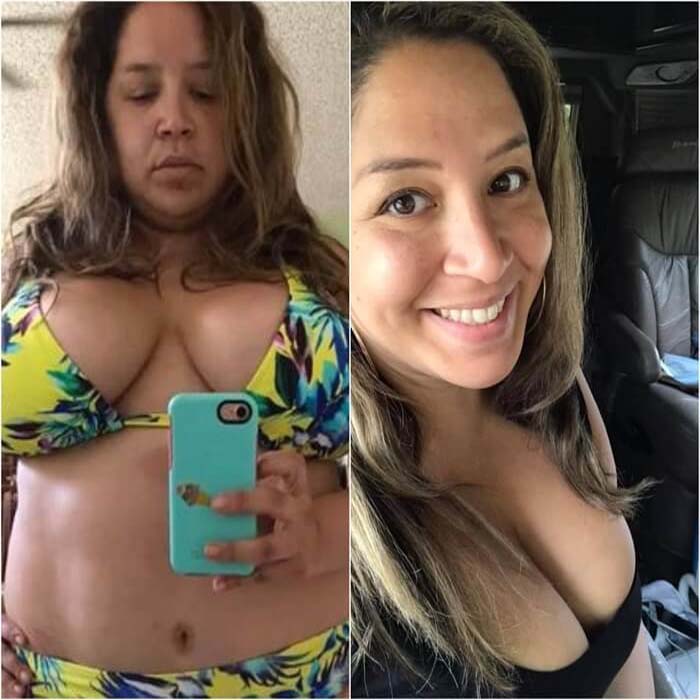 Lighter Dream Bariatrics — photo 14
